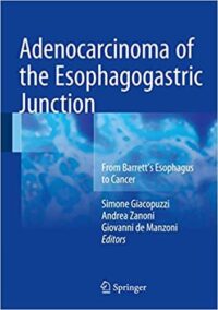 Adenocarcinoma of the Esophagogastric Junction by Simone Giacopuzzi, ISBN-13: 978-3319287744