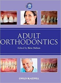 Adult Orthodontics by Birte Melsen, ISBN-13: 978-1405136198