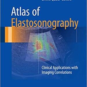 Atlas of Elastosonography: Clinical Applications with Imaging Correlations, ISBN-13: 978-3319441993