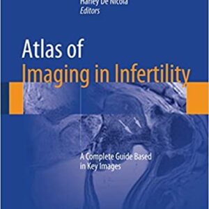 Atlas of Imaging in Infertility: A Complete Guide Based in Key Images, ISBN-13: 978-3319138923