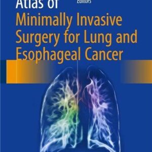 Atlas of Minimally Invasive Surgery for Lung and Esophageal Cancer, ISBN-13: 978-9402408331