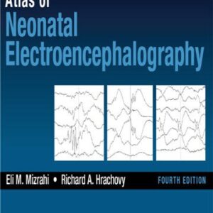 Atlas of Neonatal Electroencephalography 4th Edition by Eli M. Mizrahi, ISBN-13: 978-1620700679