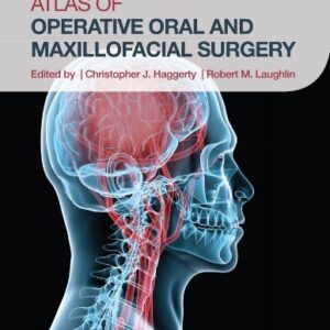 Atlas of Operative Oral and Maxillofacial Surgery 1st Edition, ISBN-13: 978-1118442340