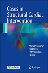 Cases in Structural Cardiac Intervention by Anitha Varghese, ISBN-13: 978-1447149804