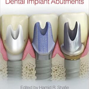 Clinical and Laboratory Manual of Dental Implant Abutments, ISBN-13: 978-1119949817