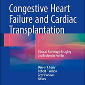 Congestive Heart Failure and Cardiac Transplantation, ISBN-13: 978-3319445755