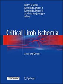 Critical Limb Ischemia: Acute and Chronic by Robert S. Dieter, ISBN-13: 978-3319319896