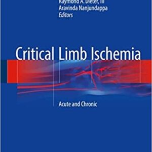 Critical Limb Ischemia: Acute and Chronic by Robert S. Dieter, ISBN-13: 978-3319319896