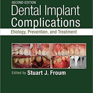 Dental Implant Complications: Etiology, Prevention, and Treatment 2nd Edition, ISBN-13: 978-1118976456