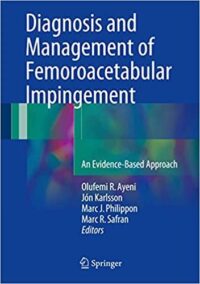 Diagnosis and Management of Femoroacetabular Impingement, ISBN-13: 978-3319319988