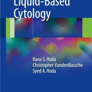 Diagnostic Liquid-Based Cytology 2017 Edition by Rana S. Hoda, ISBN-13: 978-3662539033