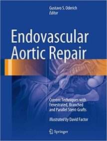 Endovascular Aortic Repair by Gustavo S. Oderich, ISBN-13: 978-3319151915