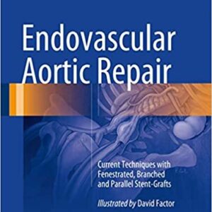 Endovascular Aortic Repair by Gustavo S. Oderich, ISBN-13: 978-3319151915