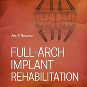Full-Arch Implant Rehabilitation 1st Edition by Arun K. Garg, ISBN-13: 978-0867158090