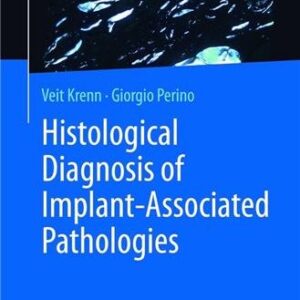 Histological Diagnosis of Implant-associated Pathologies by Veit Krenn, ISBN-13: 978-3662571880