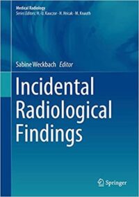 Incidental Radiological Findings by Sabine Weckbach, ISBN-13: 978-3319425795