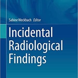 Incidental Radiological Findings by Sabine Weckbach, ISBN-13: 978-3319425795