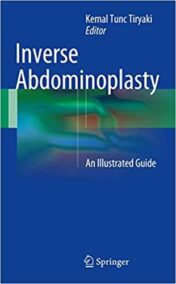 Inverse Abdominoplasty by Kemal Tunc Tiryaki, ISBN-13: 978-3319393087
