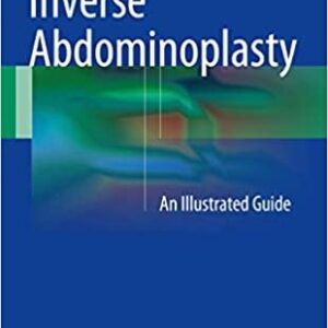Inverse Abdominoplasty by Kemal Tunc Tiryaki, ISBN-13: 978-3319393087