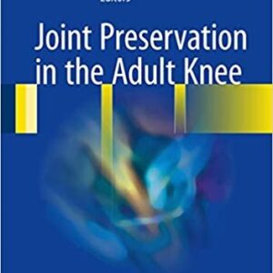 Joint Preservation in the Adult Knee, ISBN-13: 978-3319418070