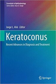 Keratoconus: Recent Advances in Diagnosis and Treatment, ISBN-13: 978-3319438795