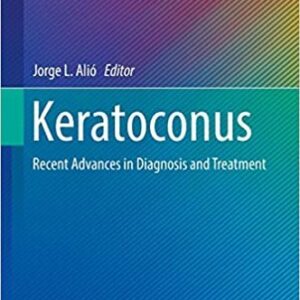 Keratoconus: Recent Advances in Diagnosis and Treatment, ISBN-13: 978-3319438795