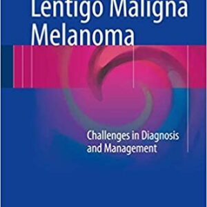 Lentigo Maligna Melanoma: Challenges in Diagnosis and Management, ISBN-13: 978-3319437859