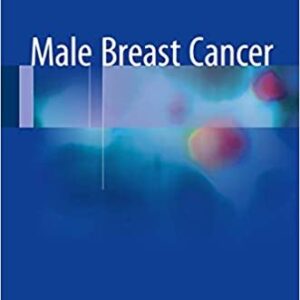 Male Breast Cancer by Ian Fentiman, ISBN-13: 978-3319046686