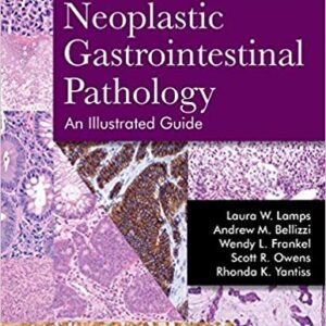 Neoplastic Gastrointestinal Pathology: An Illustrated Guide, ISBN-13: 978-1936287727
