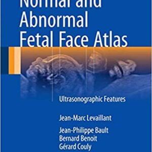 Normal and Abnormal Fetal Face Atlas: Ultrasonographic Features, ISBN-13: 978-3319437682