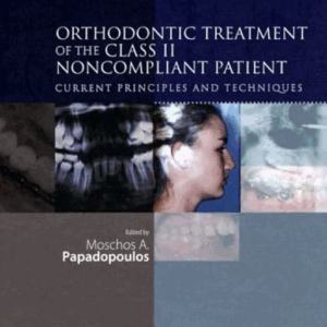 Orthodontic Treatment of the Class II Noncompliant Patient, ISBN-13: 978-0723433910