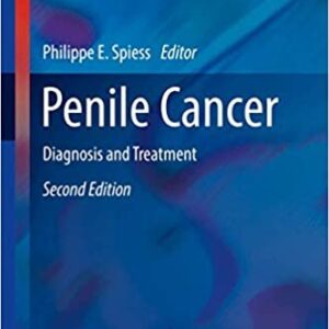 Penile Cancer: Diagnosis and Treatment 2nd Edition by Philippe E. Spiess, ISBN-13: 978-1493966776