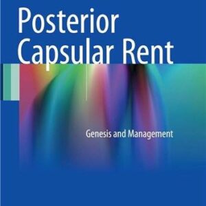 Posterior Capsular Rent: Genesis and Management 2017 Edition by Arup Chakrabarti, ISBN-13: 978-8132235842