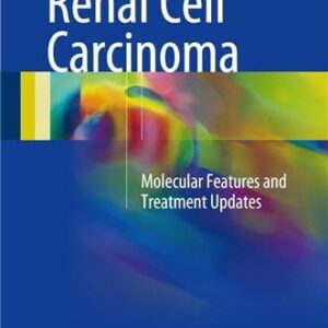 Renal Cell Carcinoma: Molecular Features and Treatment Updates by Mototsugu Oya, ISBN-13: 978-4431555308