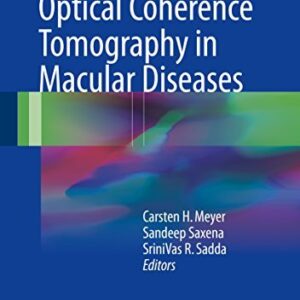 Spectral Domain Optical Coherence Tomography in Macular Diseases, ISBN-13: 978-8132236085