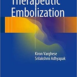 Therapeutic Embolization by Kiron Varghese, ISBN-13: 978-3319424927